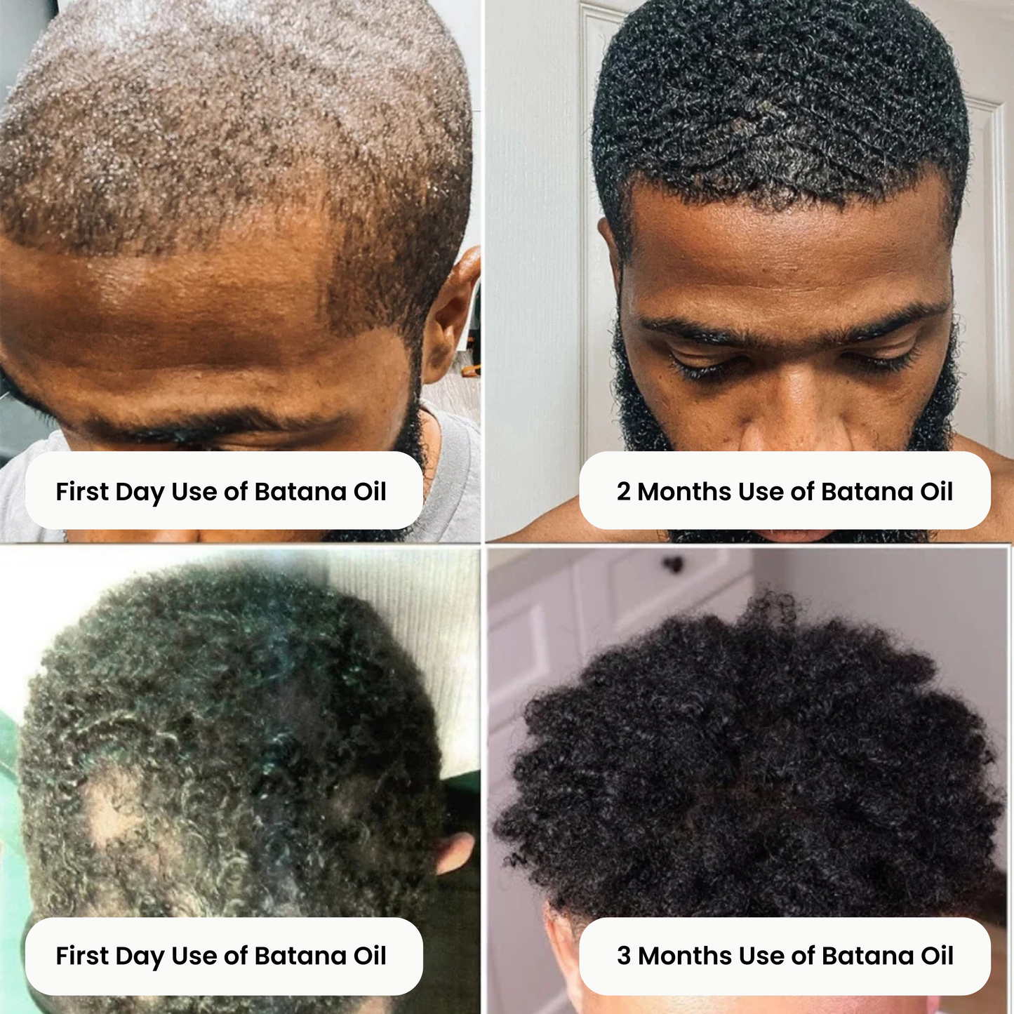 RootRise™ Batana Oil Bundle– Free Liquid Oil Included